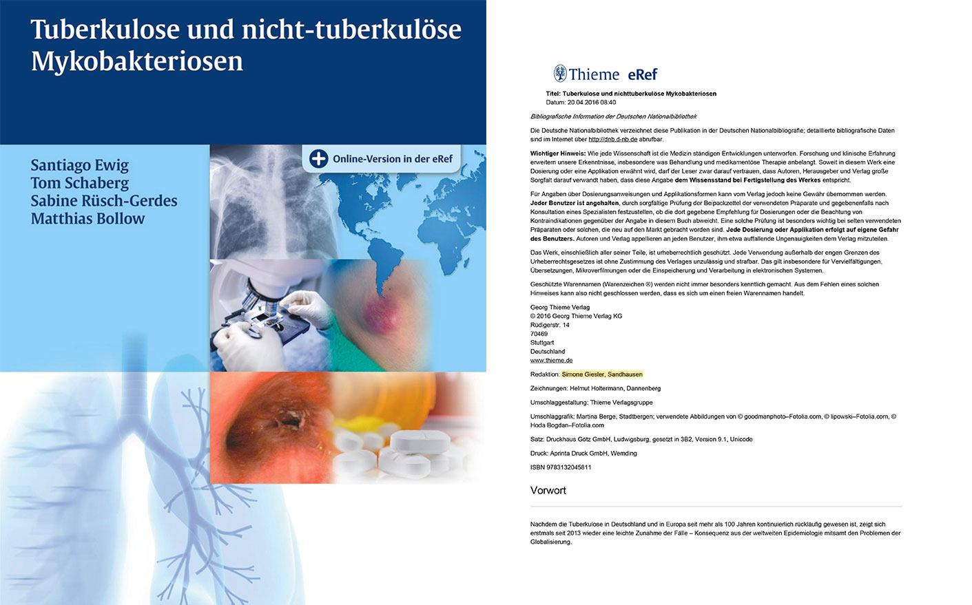 Redaktion Medizin-Fachbuch Tuberkulose, Thieme Verlag